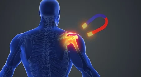 magnet therapy for shoulder joint pain