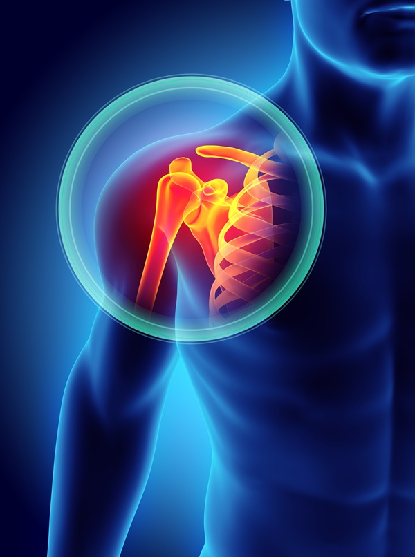 Shoulder Pain or Injury